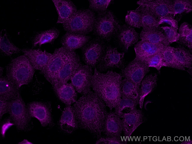 NSFL1C Antibody in Immunocytochemistry (ICC/IF)