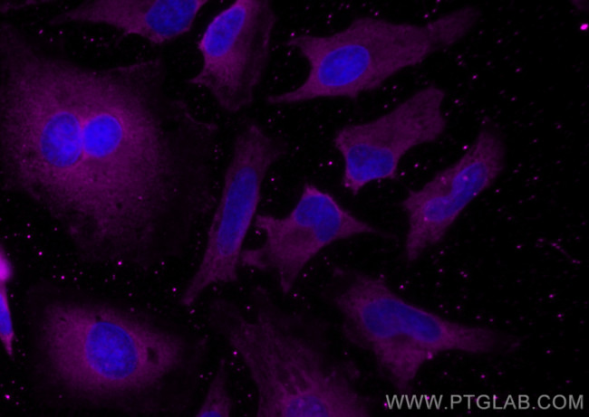 DNM2 Antibody in Immunocytochemistry (ICC/IF)
