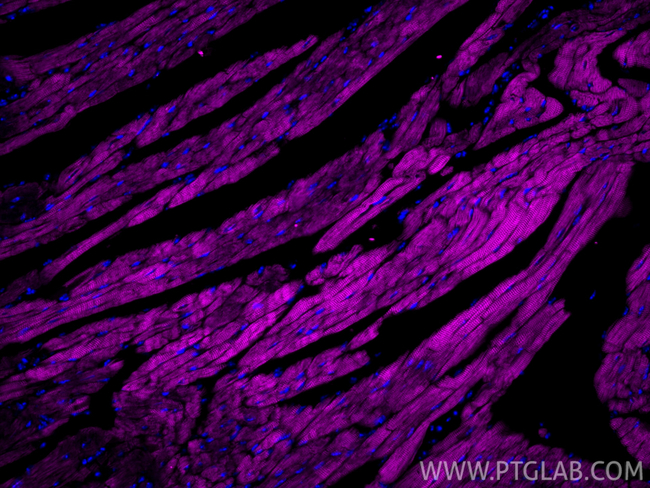 Cardiac Troponin T Antibody in Immunohistochemistry (Paraffin) (IHC (P))