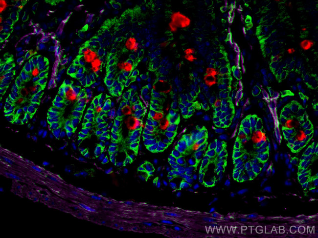smooth muscle actin Antibody in Immunohistochemistry (PFA fixed) (IHC (PFA))