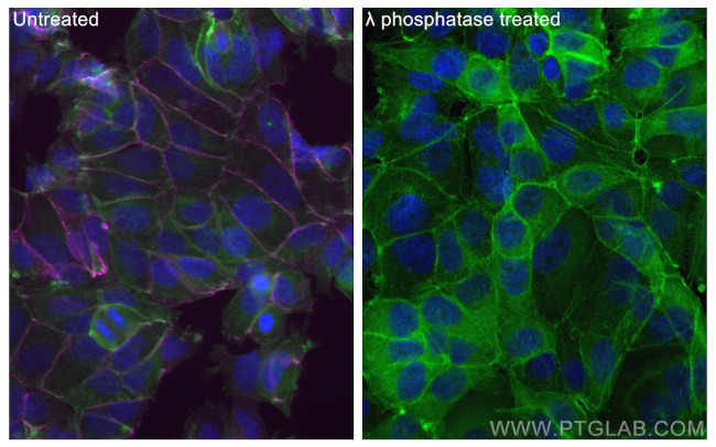 Phospho-Beta Catenin (Ser675) Antibody in Immunocytochemistry (ICC/IF)