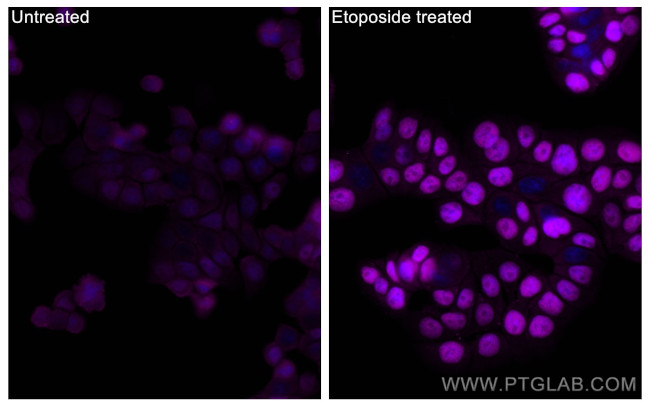 Phospho-P53 (Ser15) Antibody in Immunocytochemistry (ICC/IF)
