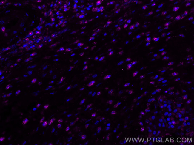 BCL2 Antibody in Immunohistochemistry (PFA fixed) (IHC (PFA))