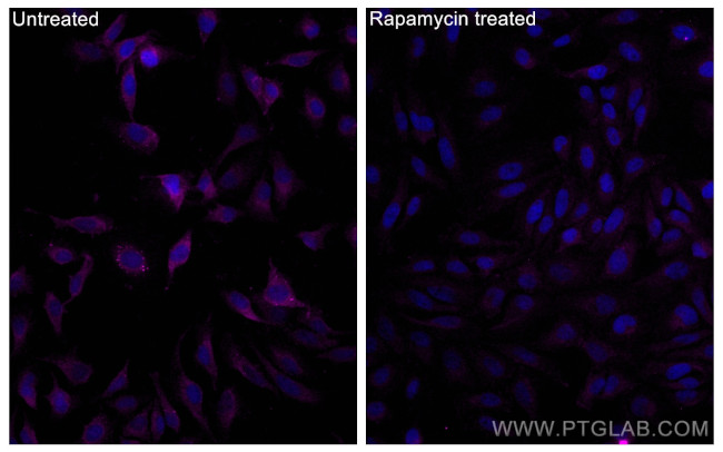 Phospho-mTOR (Ser2448) Antibody in Immunocytochemistry (ICC/IF)