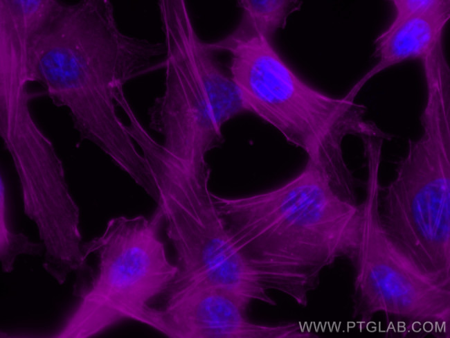 Beta Actin Antibody in Immunocytochemistry (ICC/IF)