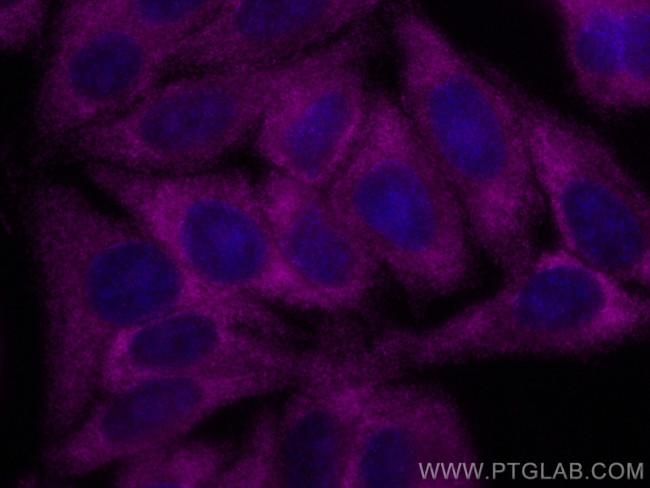 PCSK9 Antibody in Immunocytochemistry (ICC/IF)
