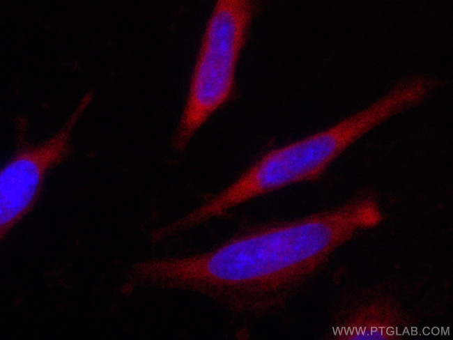 IkB Alpha Antibody in Immunocytochemistry (ICC/IF)