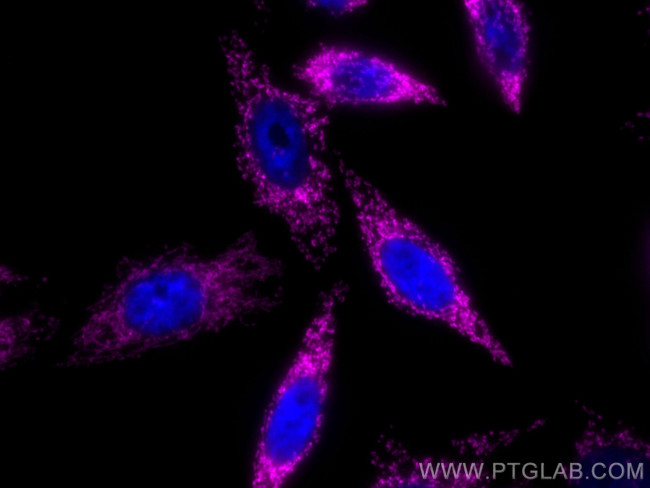 TRAP1 Antibody in Immunocytochemistry (ICC/IF)