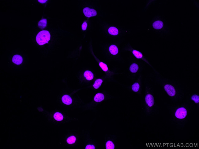 PAX8 Antibody in Immunocytochemistry (ICC/IF)
