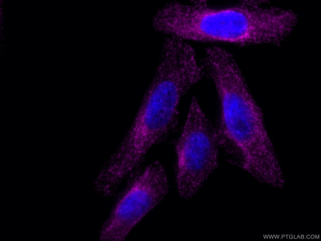 CLTA Antibody in Immunocytochemistry (ICC/IF)