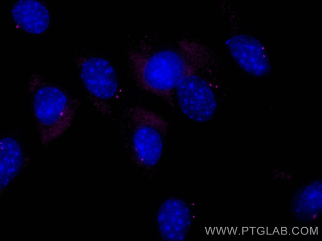 FGFR1OP Antibody in Immunocytochemistry (ICC/IF)