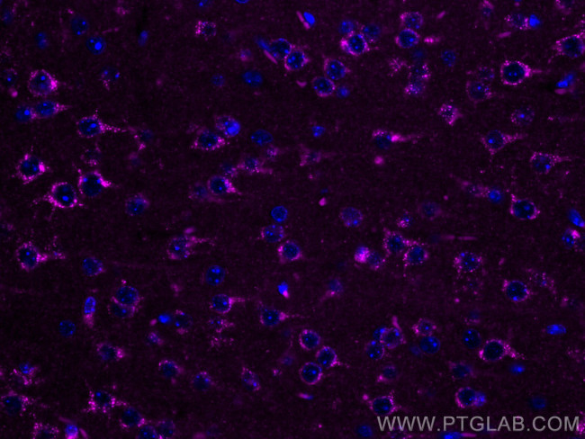 Sortilin Antibody in Immunohistochemistry (Paraffin) (IHC (P))
