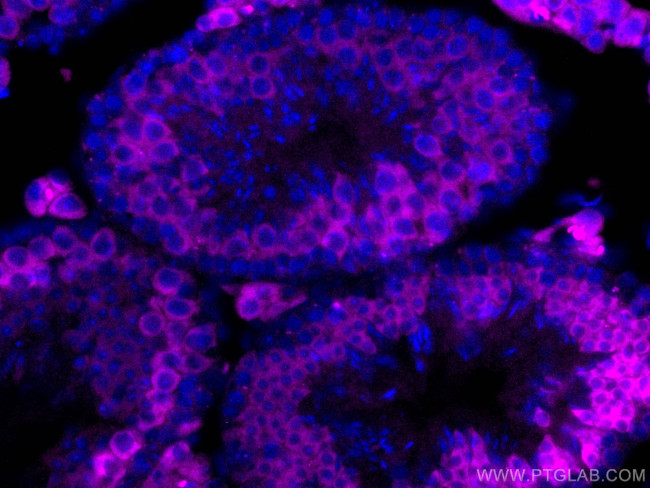 BOULE Antibody in Immunohistochemistry (Paraffin) (IHC (P))