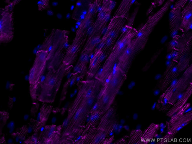 Desmin Antibody in Immunohistochemistry (Paraffin) (IHC (P))