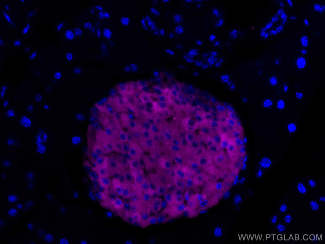 Synaptophysin Antibody in Immunohistochemistry (Paraffin) (IHC (P))