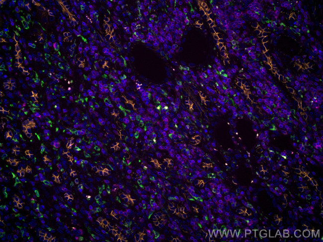 CD3 Antibody in Immunohistochemistry (Paraffin) (IHC (P))