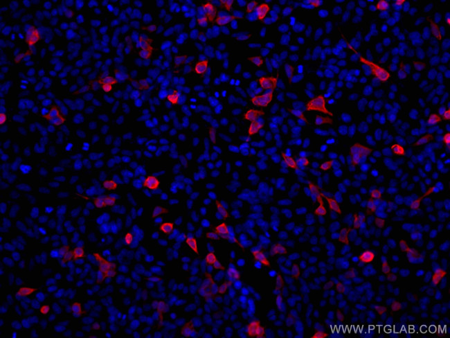 6x His, His-Tag Antibody in Immunocytochemistry (ICC/IF)