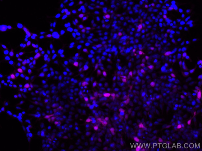 DYKDDDDK tag Antibody in Immunocytochemistry (ICC/IF)
