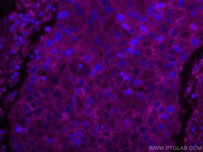 ALCAM Antibody in Immunohistochemistry (Paraffin) (IHC (P))