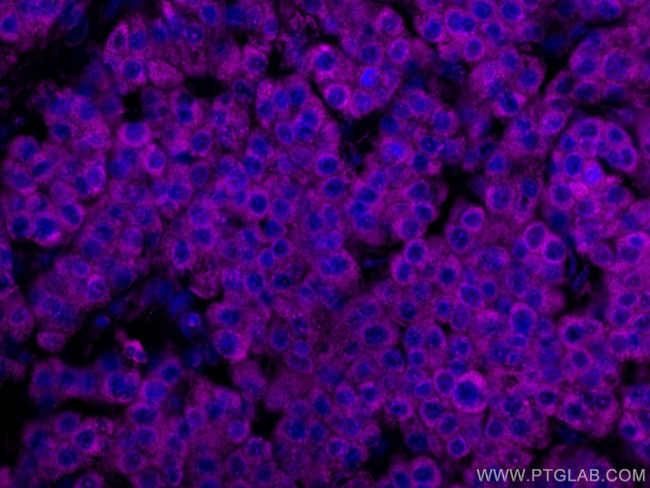SERBP1 Antibody in Immunohistochemistry (Paraffin) (IHC (P))