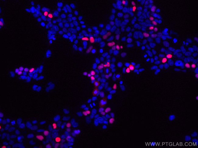 DYKDDDDK tag Antibody in Immunocytochemistry (ICC/IF)