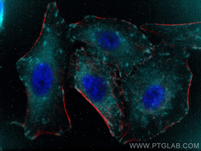 Talin-1 Antibody in Immunocytochemistry (ICC/IF)
