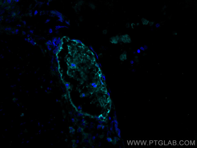 HBB Antibody in Immunohistochemistry (PFA fixed) (IHC (PFA))