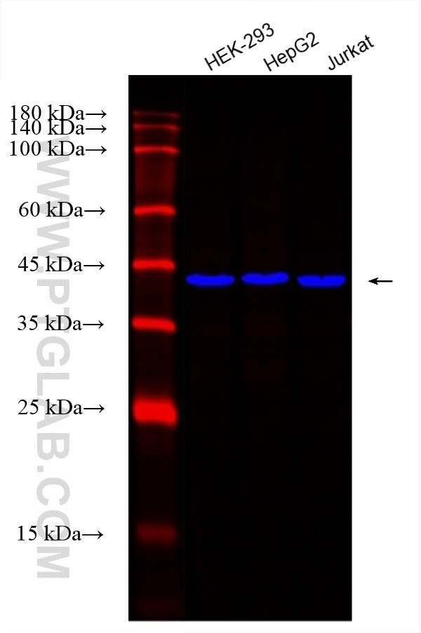 TBP Antibody in Western Blot (WB)