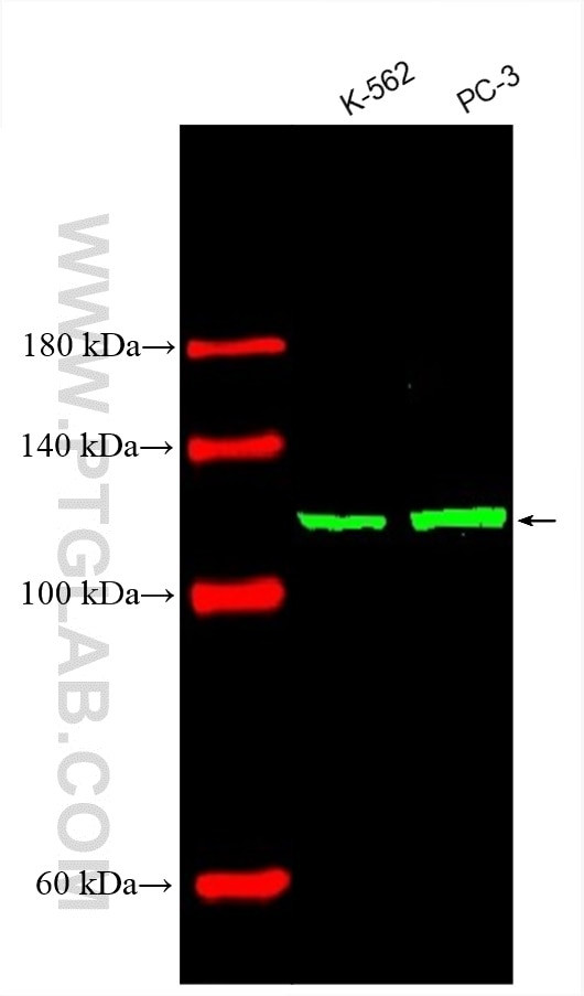 Vinculin Antibody in Western Blot (WB)