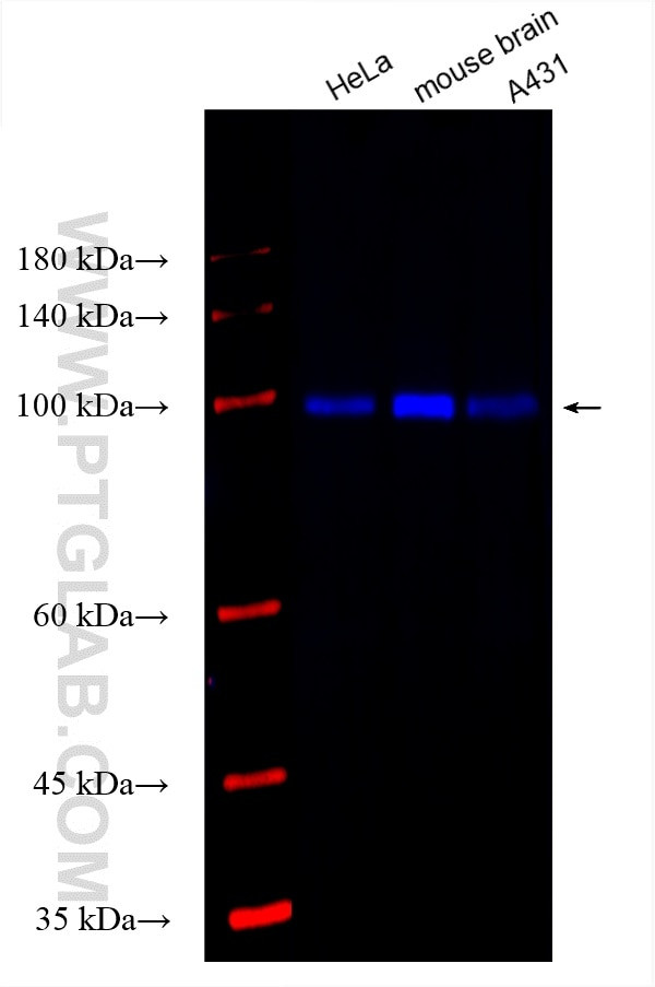 c-Cbl Antibody in Western Blot (WB)