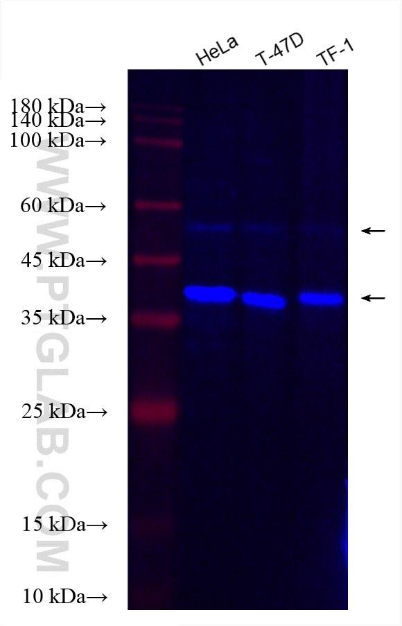 CDK9 Antibody in Western Blot (WB)