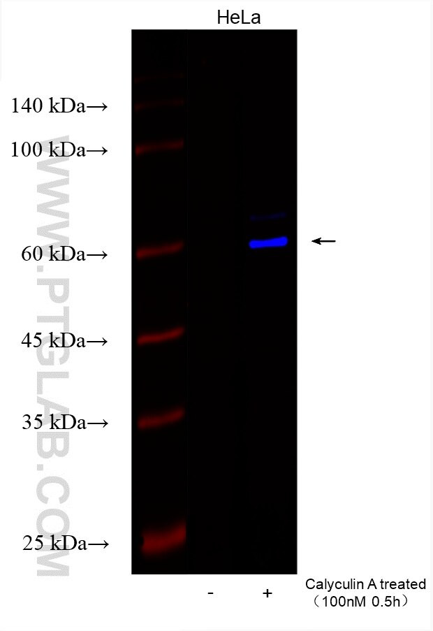 Phospho-JUN (Ser73) Antibody in Western Blot (WB)