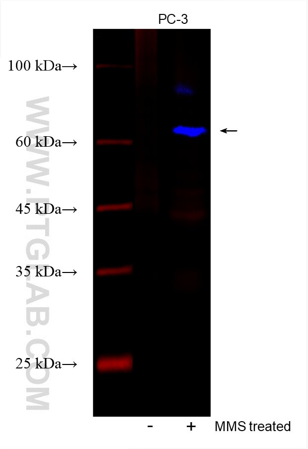 Phospho-CHEK2 (Thr68) Antibody in Western Blot (WB)
