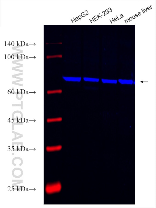 URAT1 Antibody in Western Blot (WB)