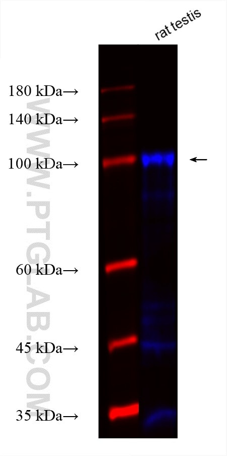 AKAP3 Antibody in Western Blot (WB)