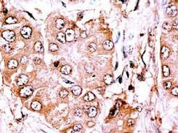 CLASP2 Antibody in Immunohistochemistry (IHC)