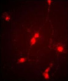 CLCN4 Antibody in Immunocytochemistry (ICC/IF)
