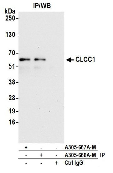 CLCC1 Antibody in Immunoprecipitation (IP)