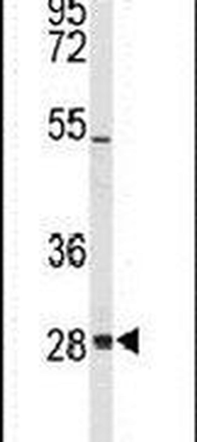 Claudin 18 Antibody in Western Blot (WB)