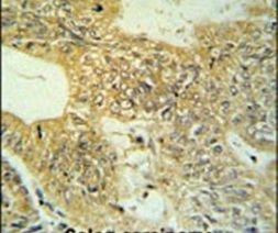 Claudin 23 Antibody in Immunohistochemistry (IHC)