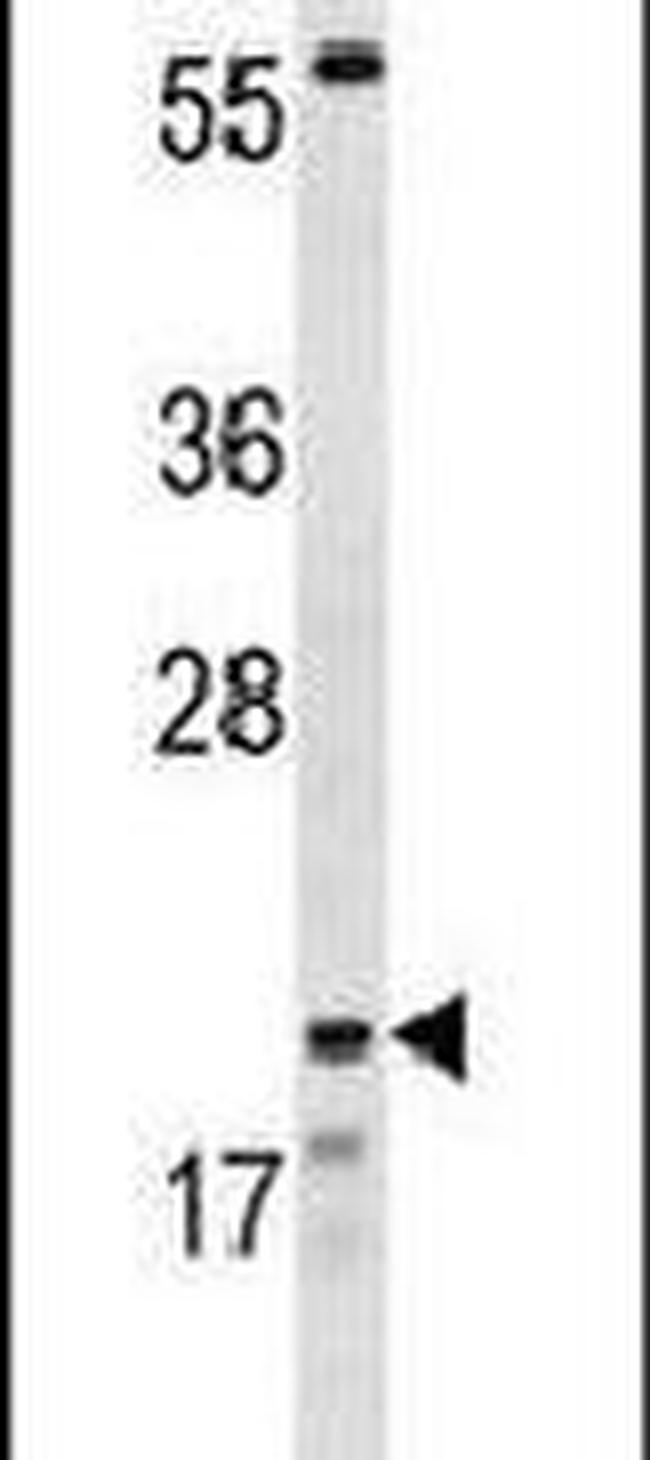 Claudin 8 Antibody in Western Blot (WB)