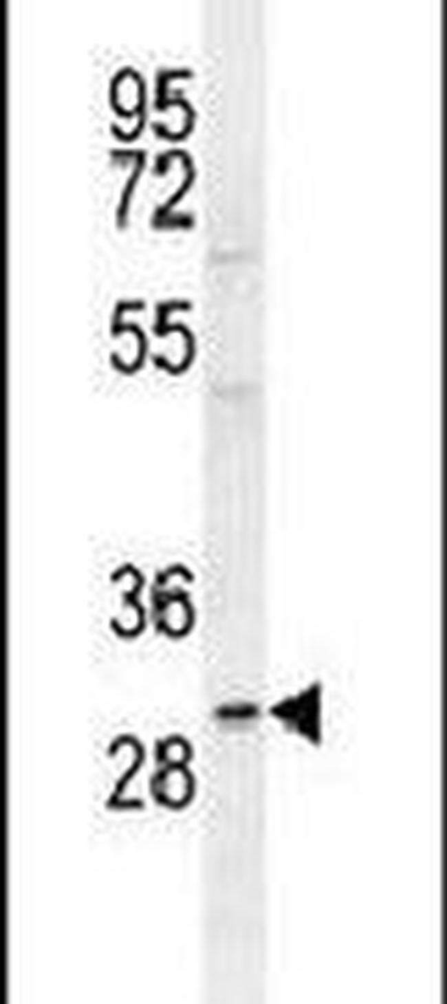 CD301 Antibody in Western Blot (WB)