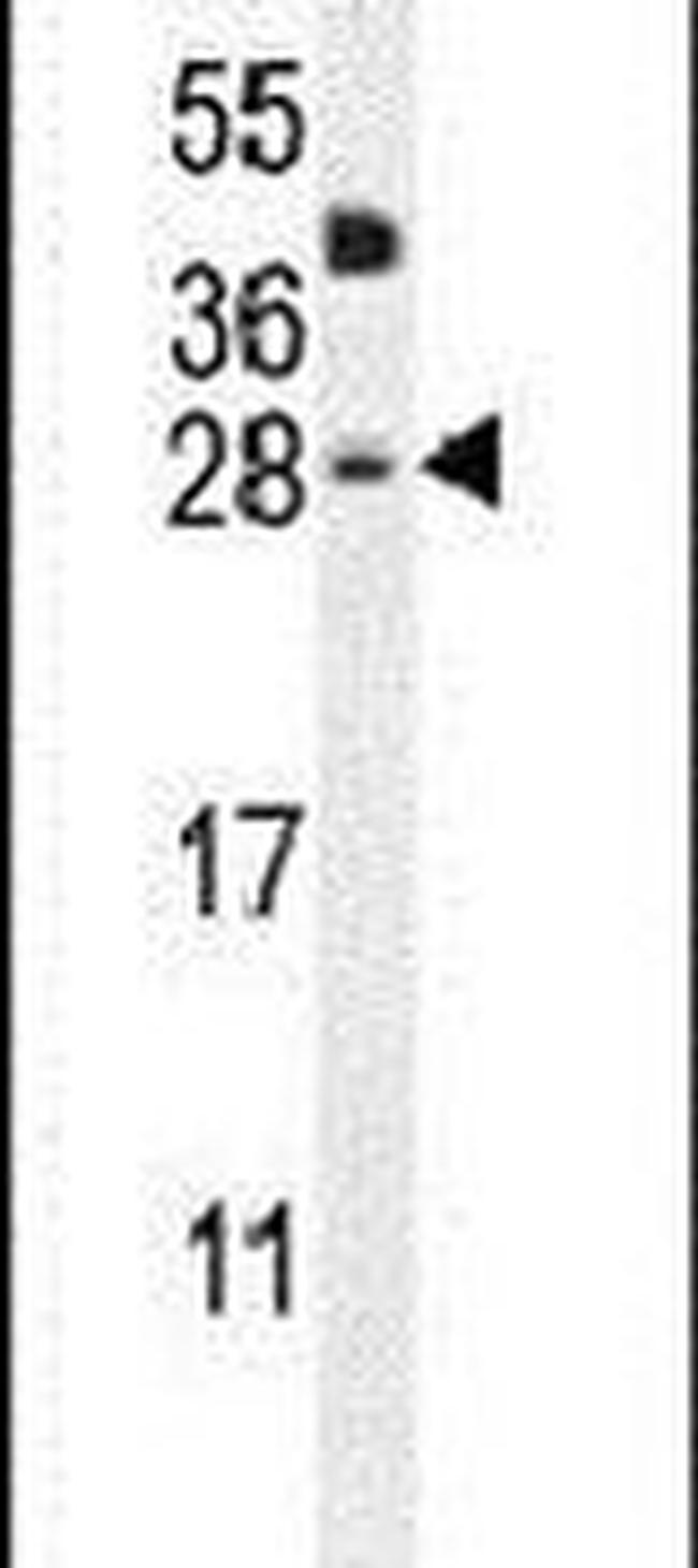 CLEC2A Antibody in Western Blot (WB)