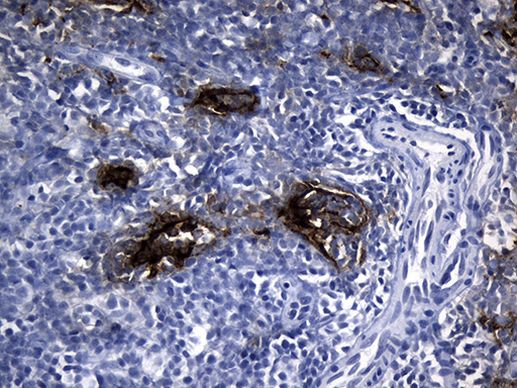 CLEC4M Antibody in Immunohistochemistry (Paraffin) (IHC (P))