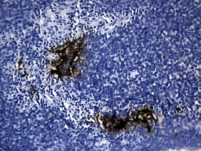 CLEC4M Antibody in Immunohistochemistry (Paraffin) (IHC (P))