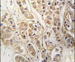 CLIC4 Antibody in Immunohistochemistry (IHC)