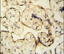 CLIC6 Antibody in Immunohistochemistry (IHC)