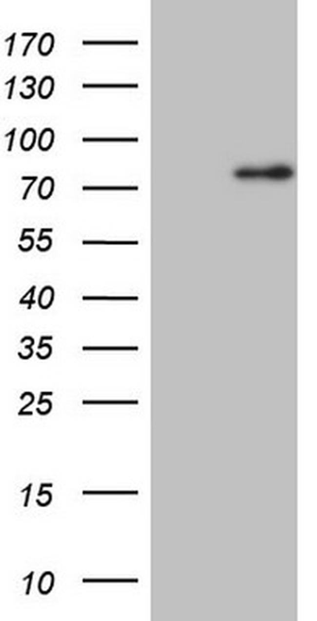 CLINT1 Antibody in Western Blot (WB)