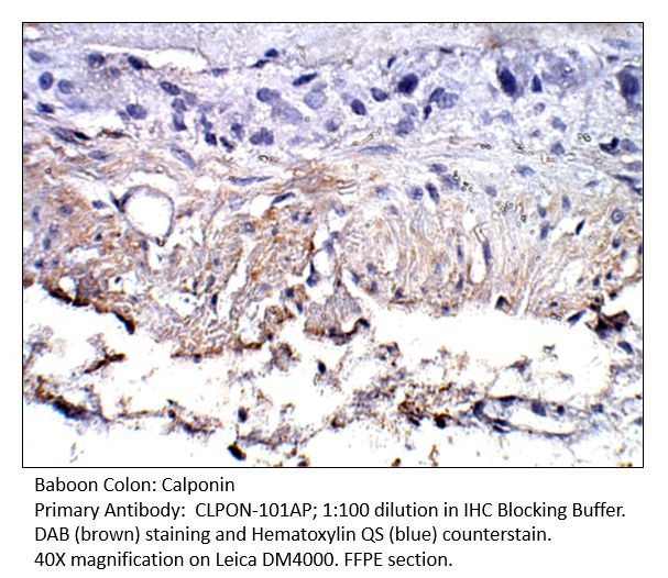 Calponin Antibody in Immunohistochemistry (IHC)