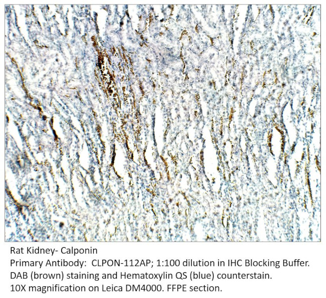 Calponin Antibody in Immunohistochemistry (IHC)